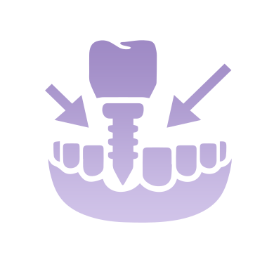 Orthodontics (Invisalign)